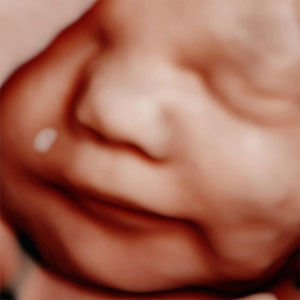 Baby yawn 4D ultrasound